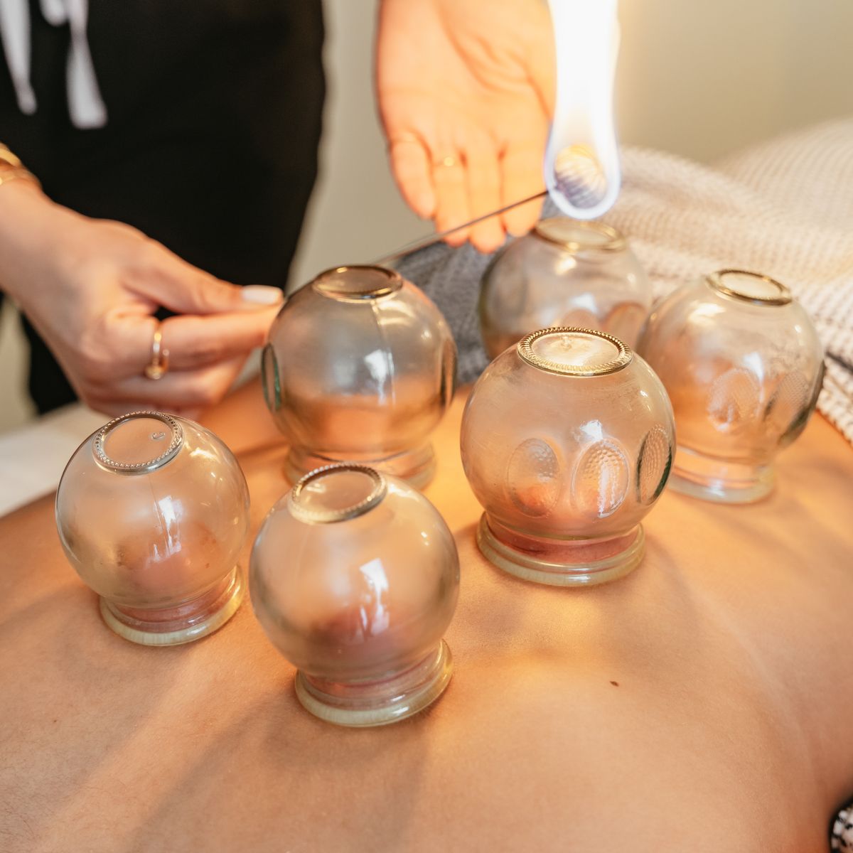 Массаж с банками в Spa Lotos